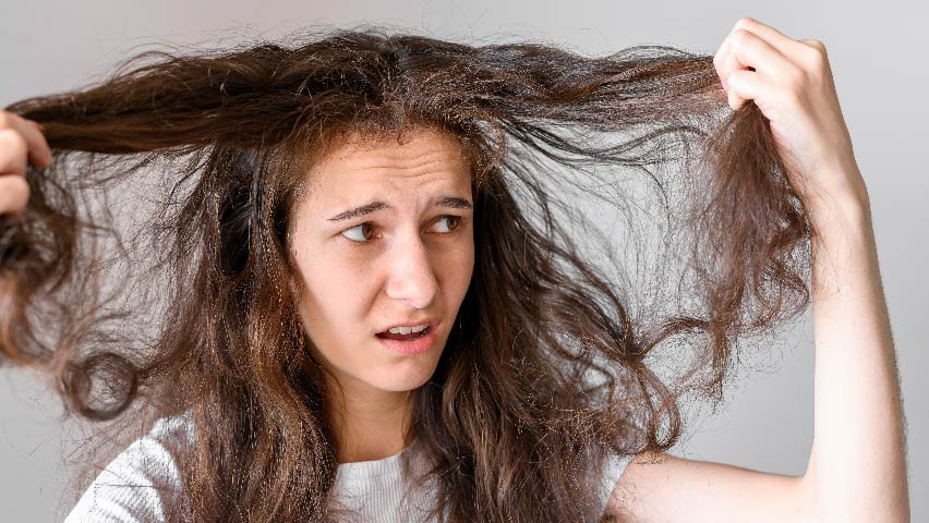 Rambut Kusut dan Anemia: Kenapa Ada Hubungannya?