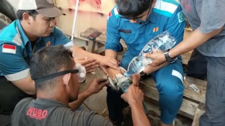 Gara-Gara Cincin Nyangkut, Petugas Damkar Mamuju Ikut Turun Tangan