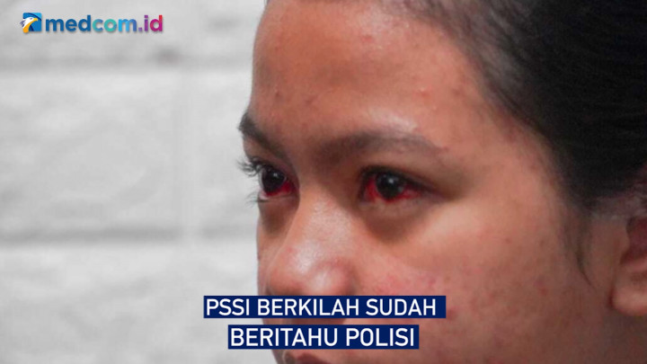 Soal Gas Air Mata di Stadion Kanjuruhan, TGIPF: PSSI Berkilah Sudah Beri Tahu Polisi