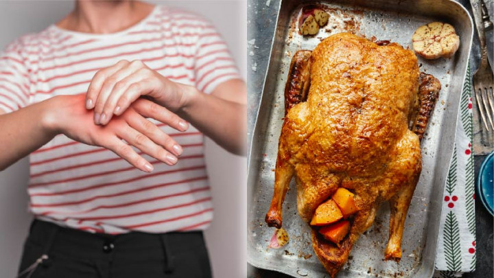 Sebaiknya Hindari 6 Jenis Makanan Penyebab Asam Urat Tinggi