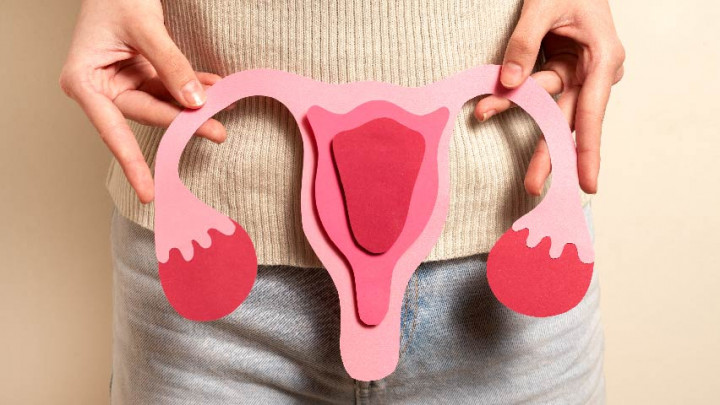 Kenali Gejala dan Penyebab Sindrom Polikistik Ovarium (PCOS) pada Wanita