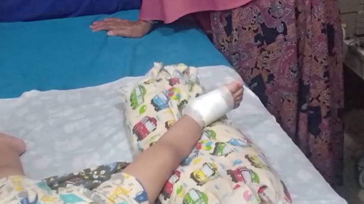 Balita 1,5 Tahun di Lampung Jadi Korban Peluru Nyasar