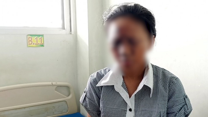 Gegara Ponsel Meledak, Wajah Seorang Siswi SMK di Ponorogo Alami Luka Bakar