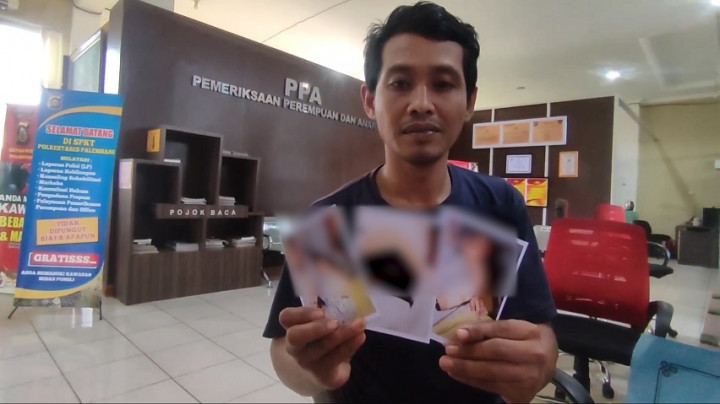 Diduga Akibat Kelalaian, Jari Bayi 8 Bulan di Palembang Tergunting Perawat