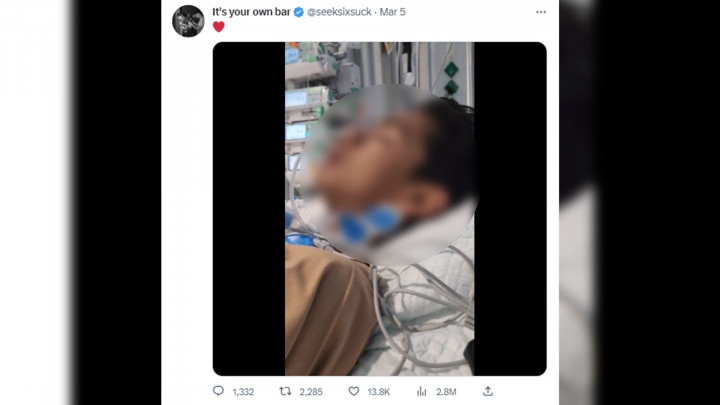 Sang Ayah Bagikan Kondisi Terkini David Ozora Korban Penganiayaan Mario Dandy