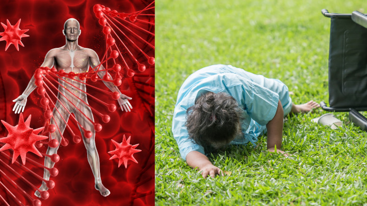 Perlu Tahu, Ini 4 Penyebab Umum Pembuluh Darah Pecah