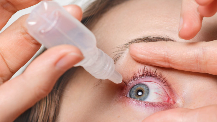 Perlu Diwaspadai, Ini 5 Efek Samping Penggunaan Obat Tetes Mata