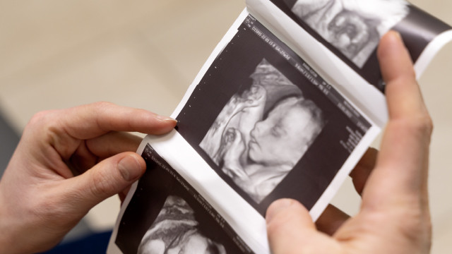 Berpotensi Menggugurkan Kandungan, Ini Makanan yang Perlu Diwaspadai