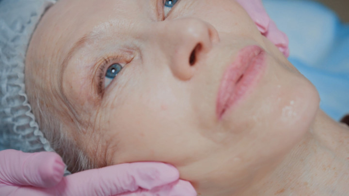 Kenali 5 Kebiasaan Penuaan Dini pada Kulit dan Cara Mengatasinya