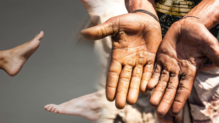 Kulit Kamu Kapalan? Ini Tips Bikin Mulus Kembali