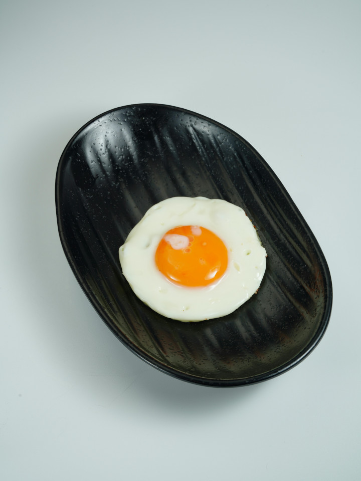 5 Kebiasaan Ini Tanpa Disadari Picu Kolesterol Tinggi