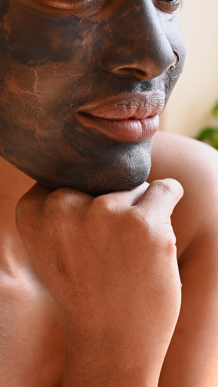 Muncul Komedo? Ini 7 Cara 'Melenyapkannya' Rekomendasi Ahli