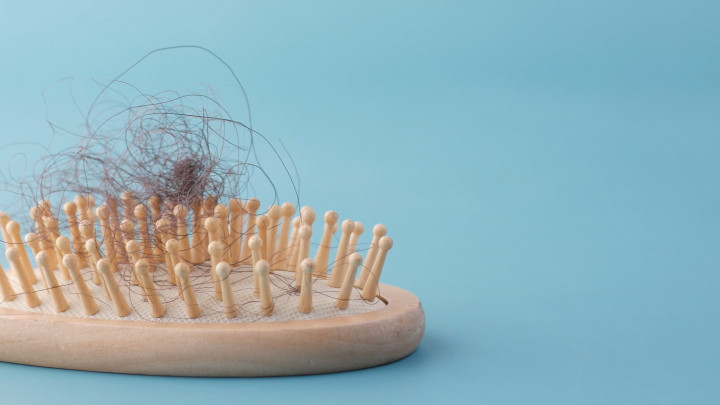 Ini 5 Vitamin yang Dibutuhkan untuk Hindari Rambut Rontok