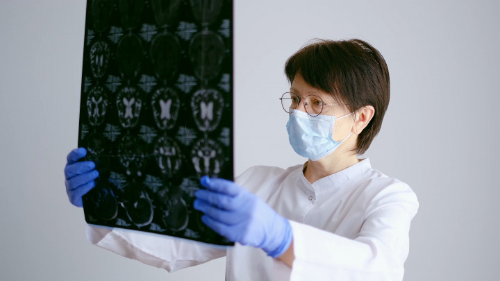 Selain Hipertensi, 5 Penyebab Lain Bisa Akibatkan Perdarahan Otak