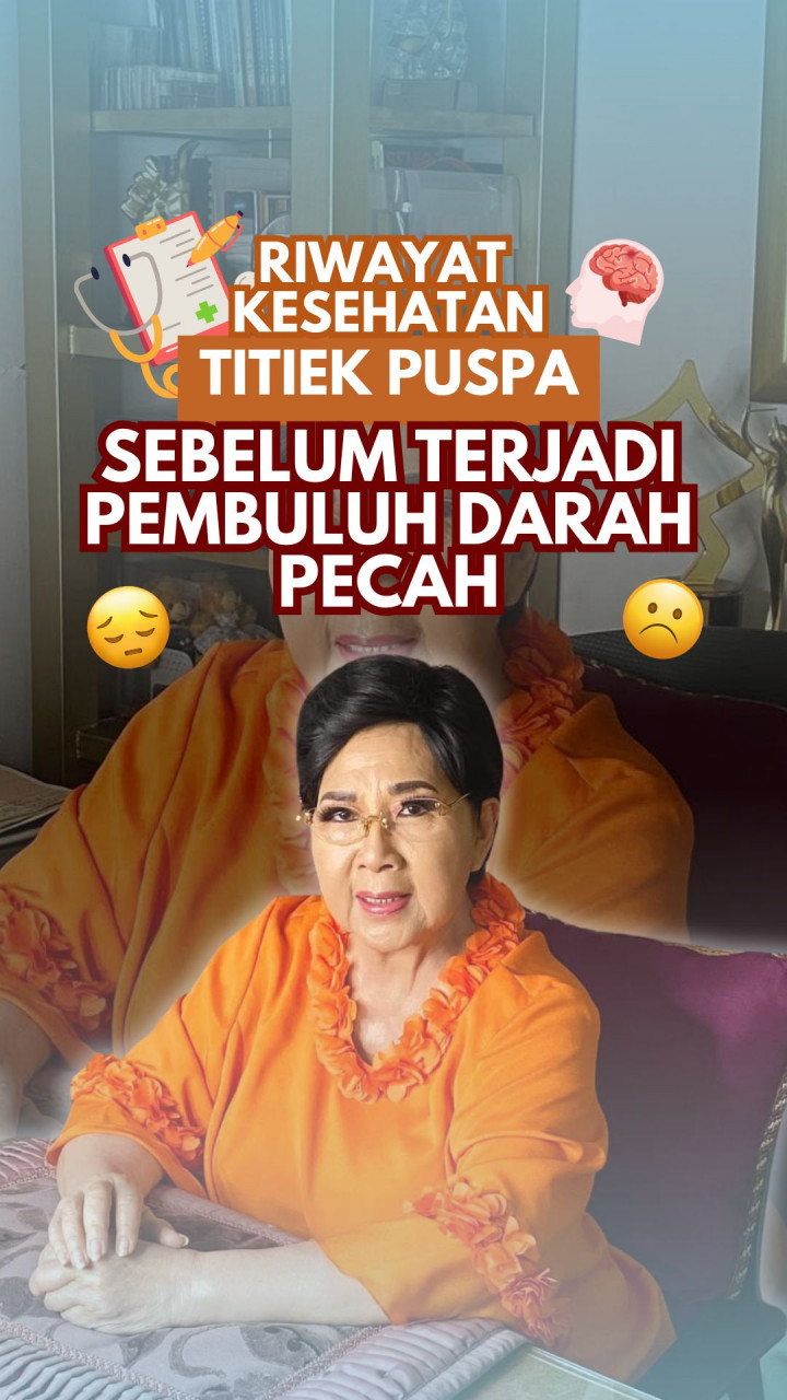Riwayat Kesehatan Titiek Puspa Sebelum Terjadi Pembuluh Darah Pecah