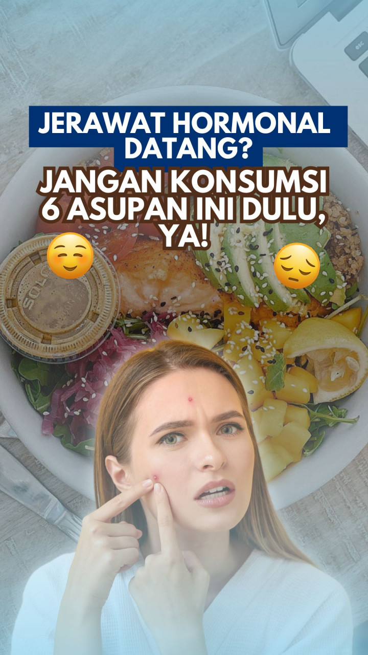 Jerawat Hormonal Datang? Jangan Konsumsi 5 Asupan Ini Dulu, Ya!