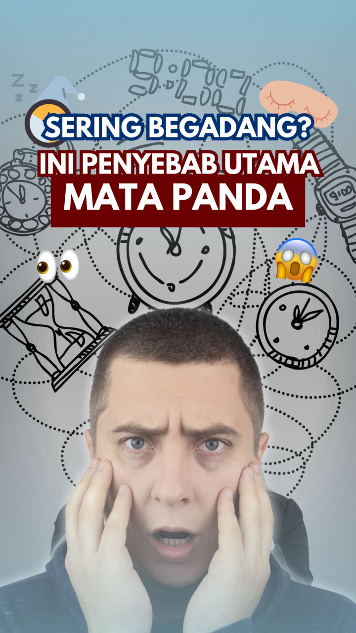 Sering Begadang? Ini Penyebab Utama Mata Panda!