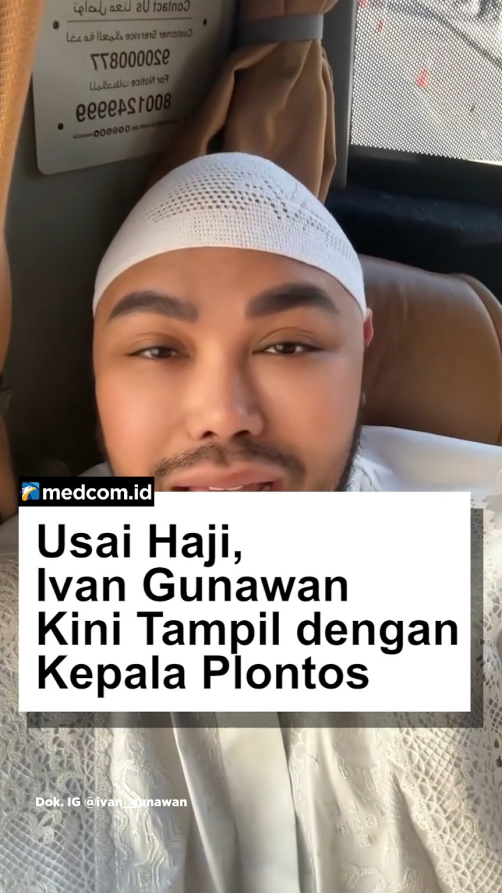 Usai Haji, Ivan Gunawan Kini Tampil dengan Kepala Plontos