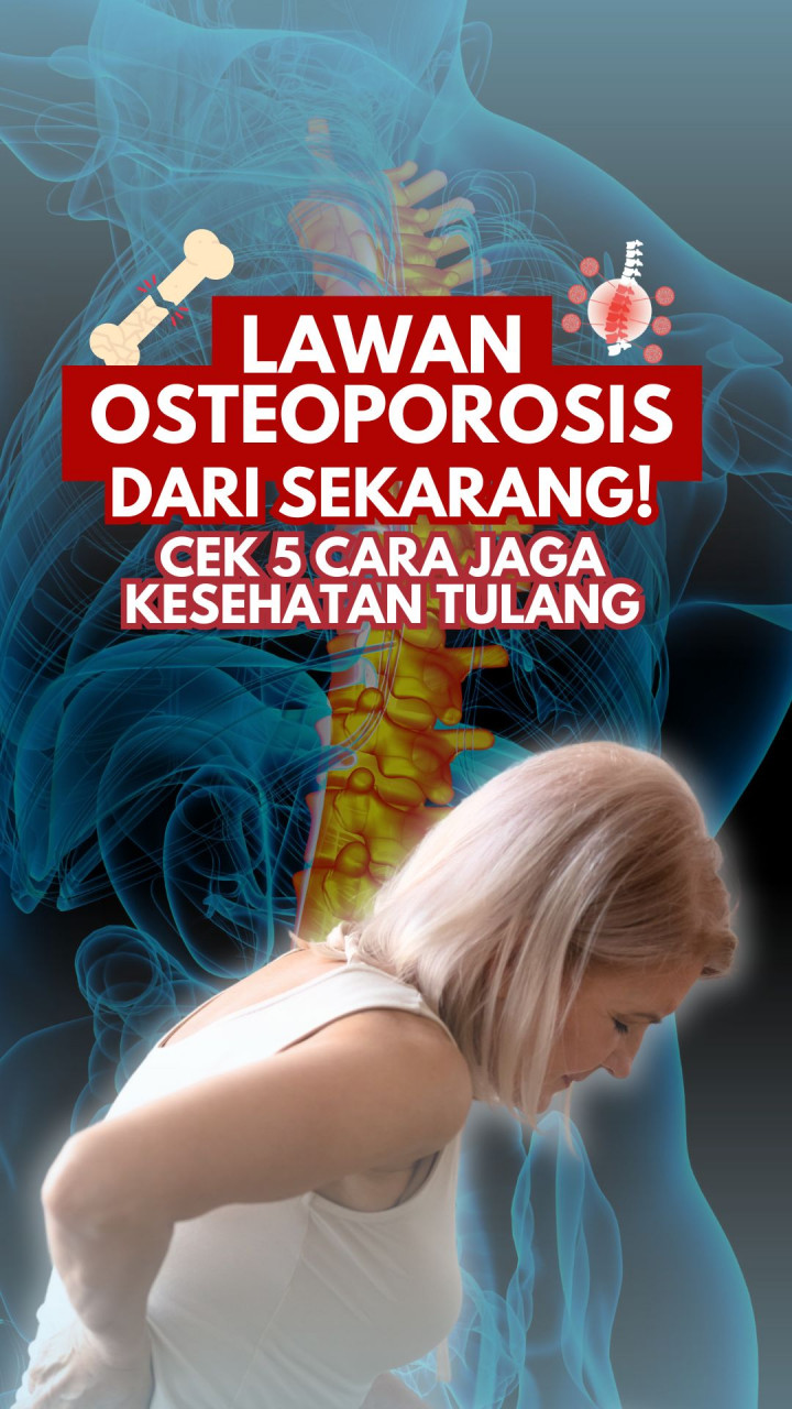 Lawan Osteoporosis dari Sekarang! Cek 5 Cara Jaga Kesehatan Tulang