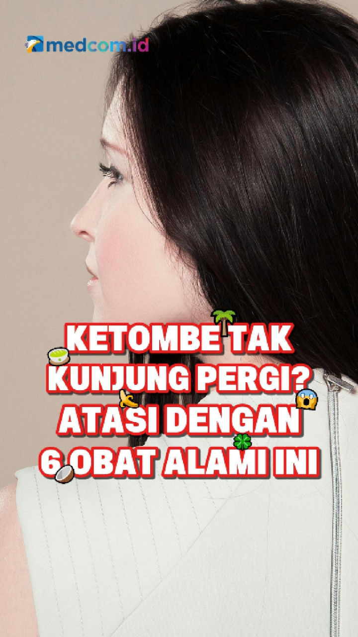 Ketombe Tak Kunjung Pergi? Atasi dengan 6 Obat Alami Ini