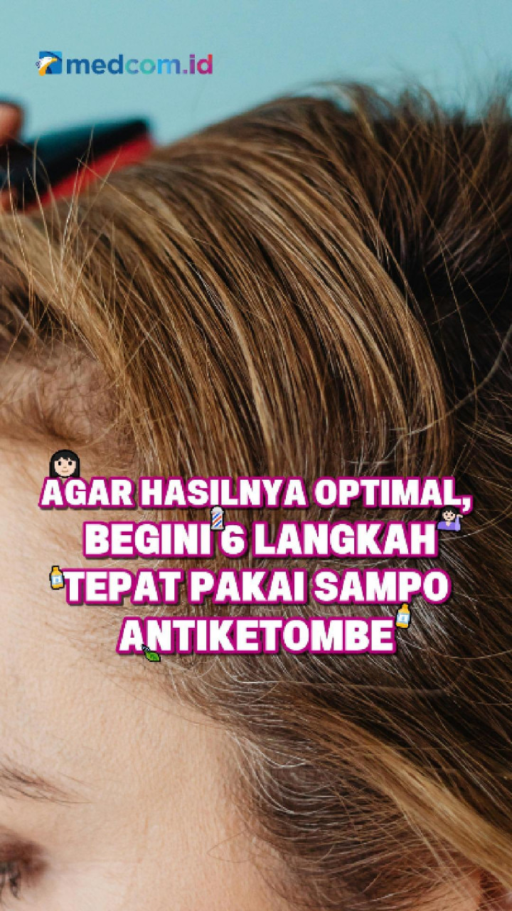 Agar Hasilnya Optimal, Begini 6 Langkah Tepat Pakai Sampo Antiketombe