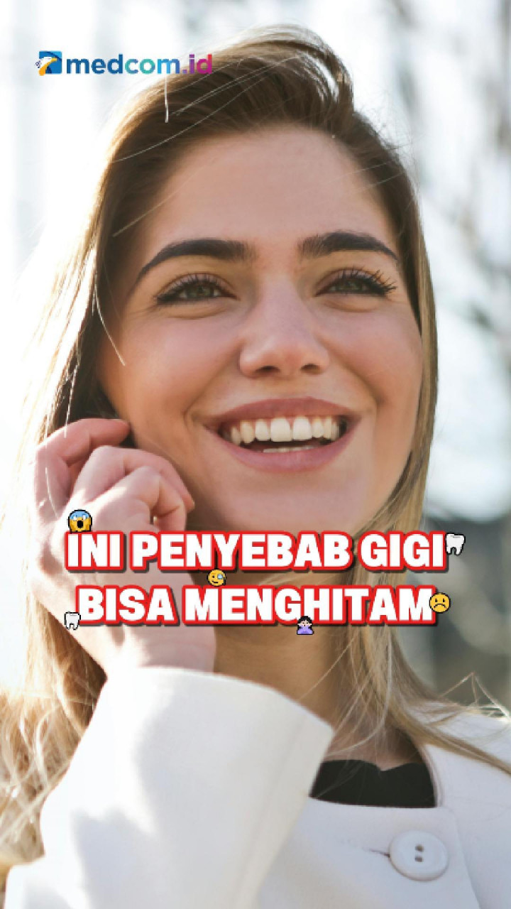 Ini Penyebab Gigi Bisa Menghitam