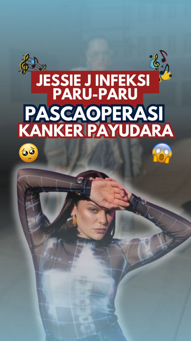 Jessie J Infeksi Paru-paru Pascaoperasi Kanker Payudara