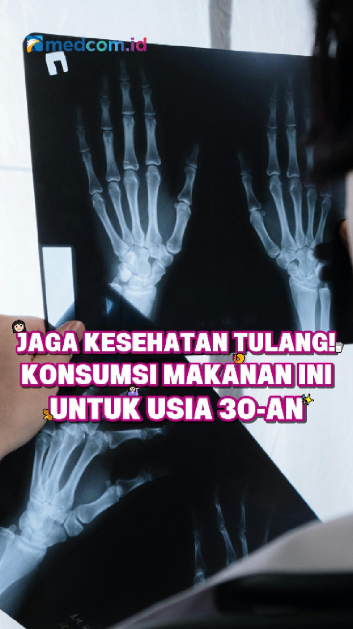 Jaga Kesehatan Tulang! Konsumsi Makanan Ini untuk Usia 30-an
