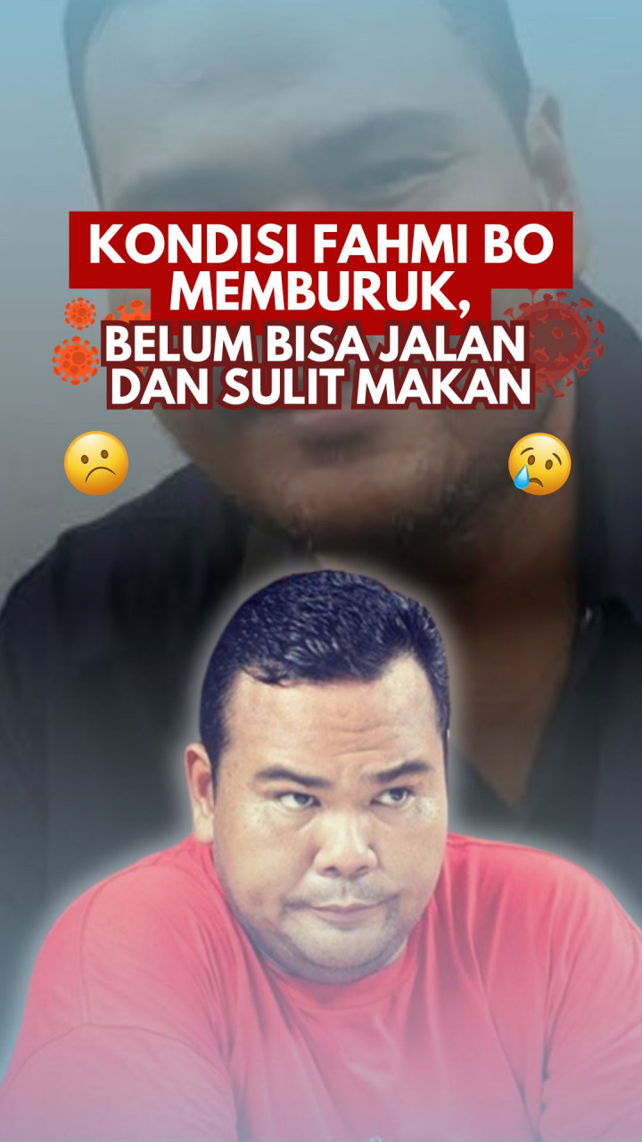 Kondisi Fahmi Bo Memburuk, Belum Bisa Jalan dan Sulit Makan