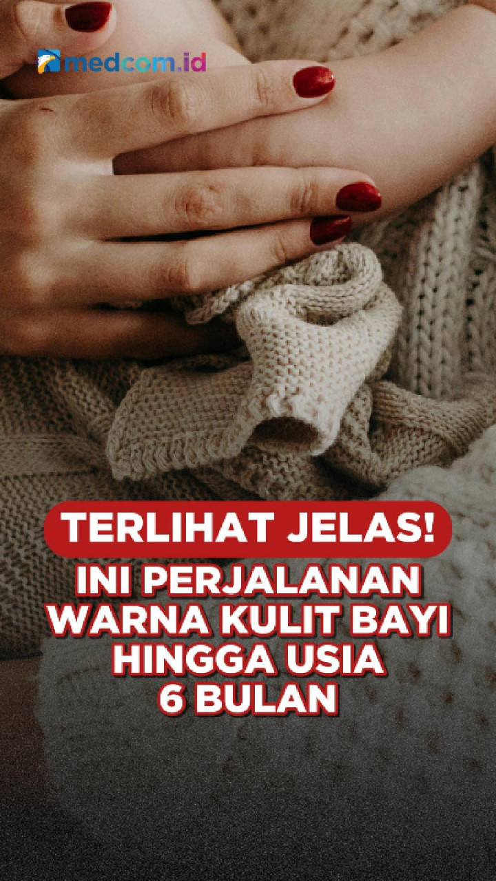 Terlihat Jelas! Ini Perjalanan Warna Kulit Bayi Hingga Usia 6 Bulan