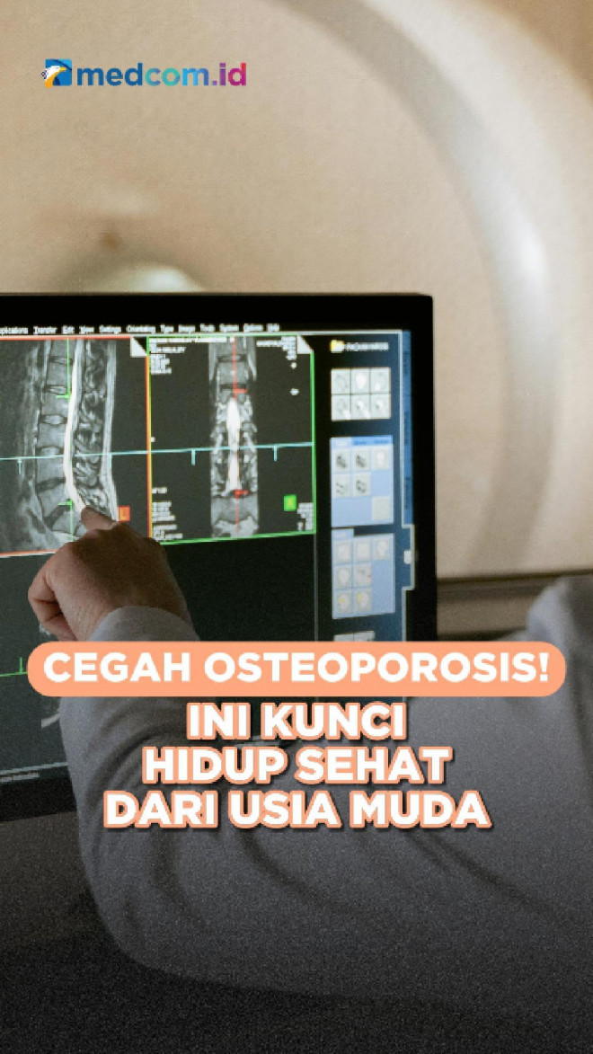 Cegah Osteoporosis! Ini Kunci Hidup Sehat dari Usia Muda