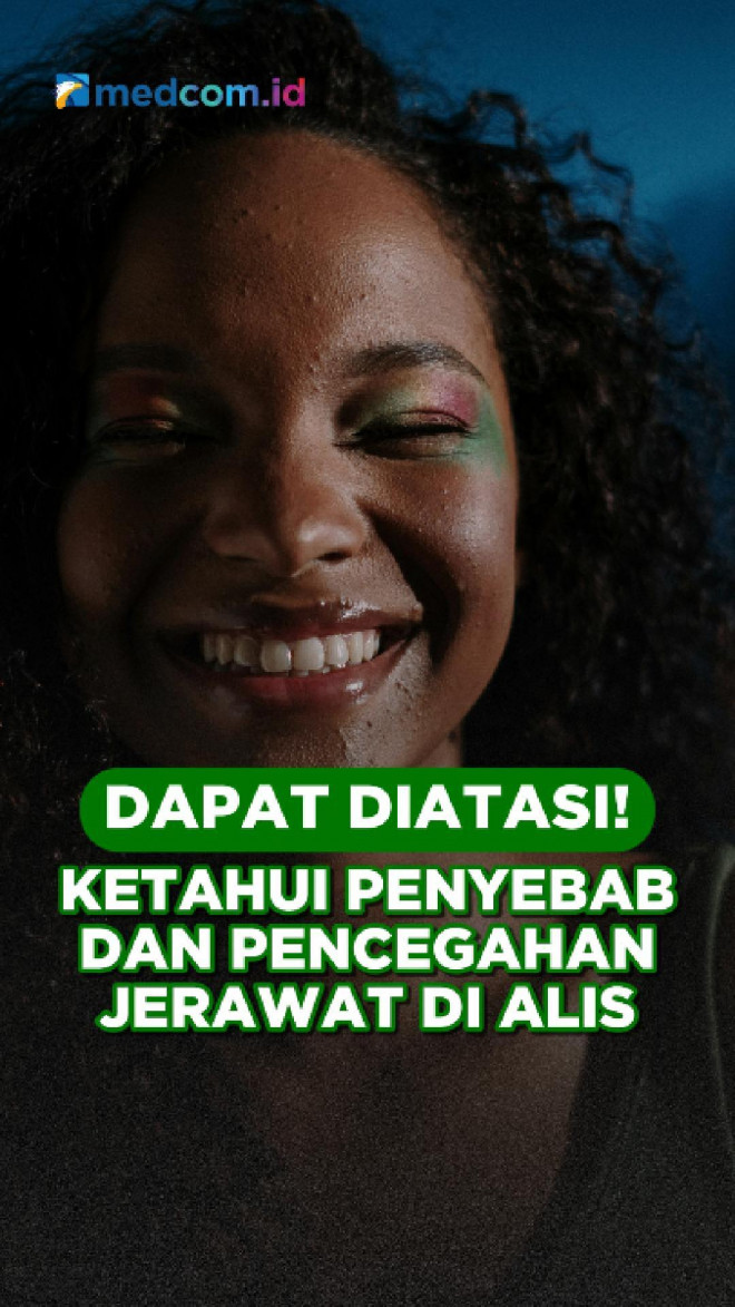 Dapat Diatasi! Ketahui Penyebab dan Pencegahan Jerawat di Alis