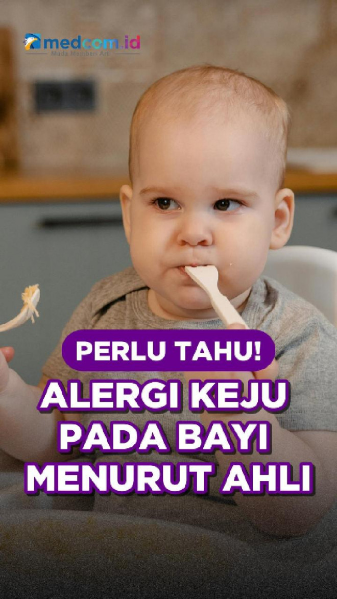 Perlu Tahu! Alergi Keju pada Bayi Menurut Ahli
