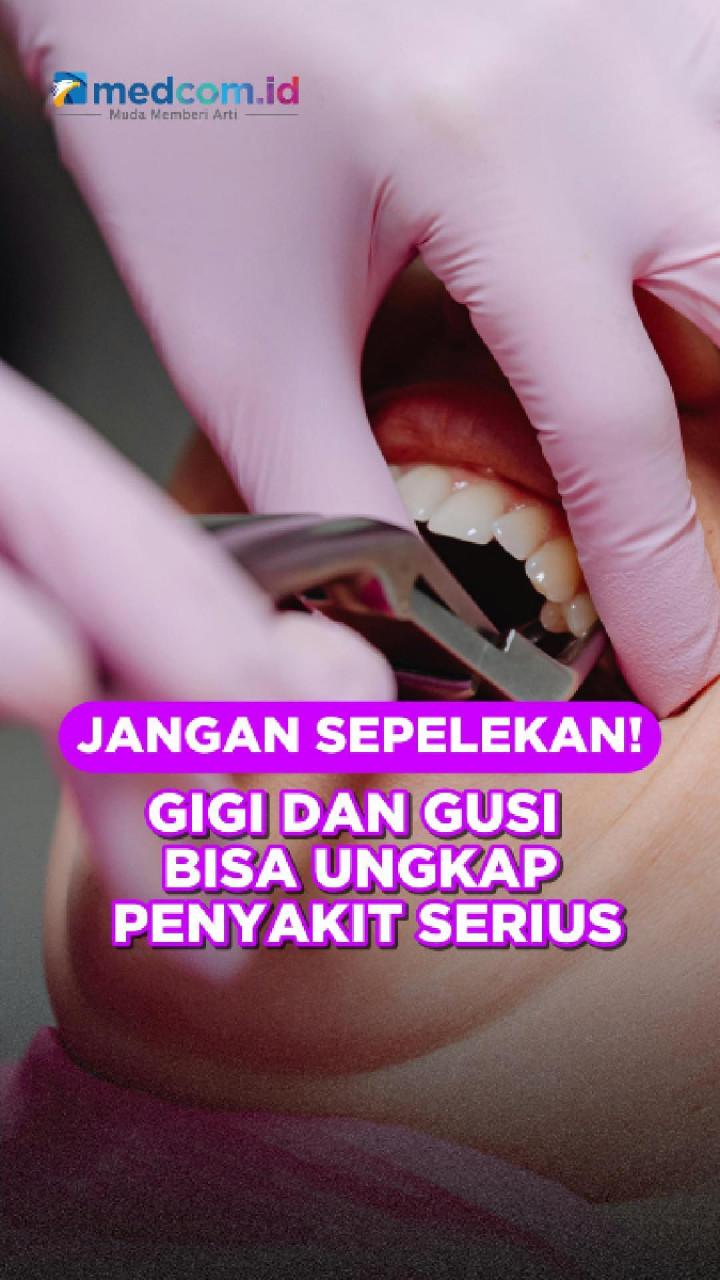 Jangan Sepelekan! Gigi dan Gusi Bisa Ungkap Penyakit Serius