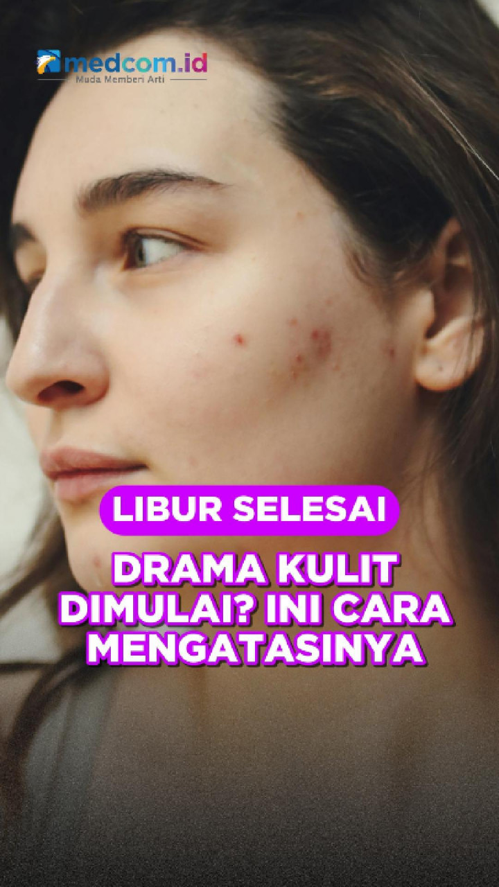 Libur Selesai, Drama Kulit Dimulai? Ini Cara Mengatasinya