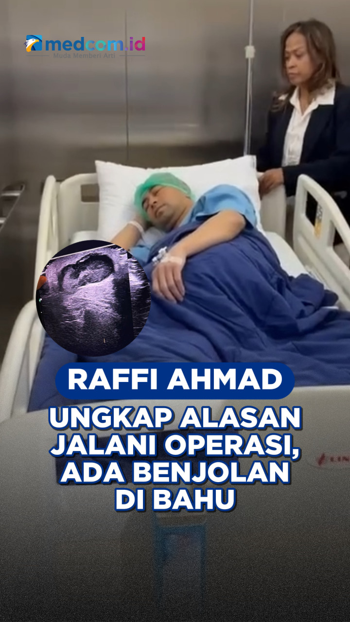 Raffi Ahmad Ungkap Alasan Jalani Operasi, Ada Benjolan di Bahu