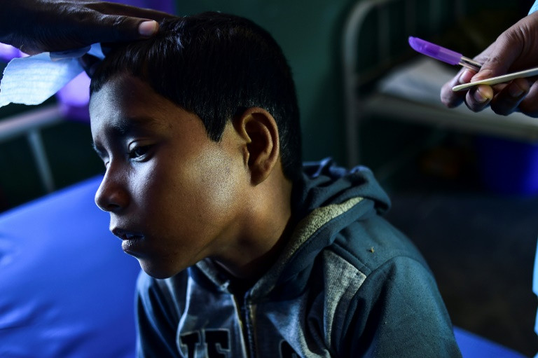 Deadly 'Long-Lost Disease' Rages through Rohingya Camps
