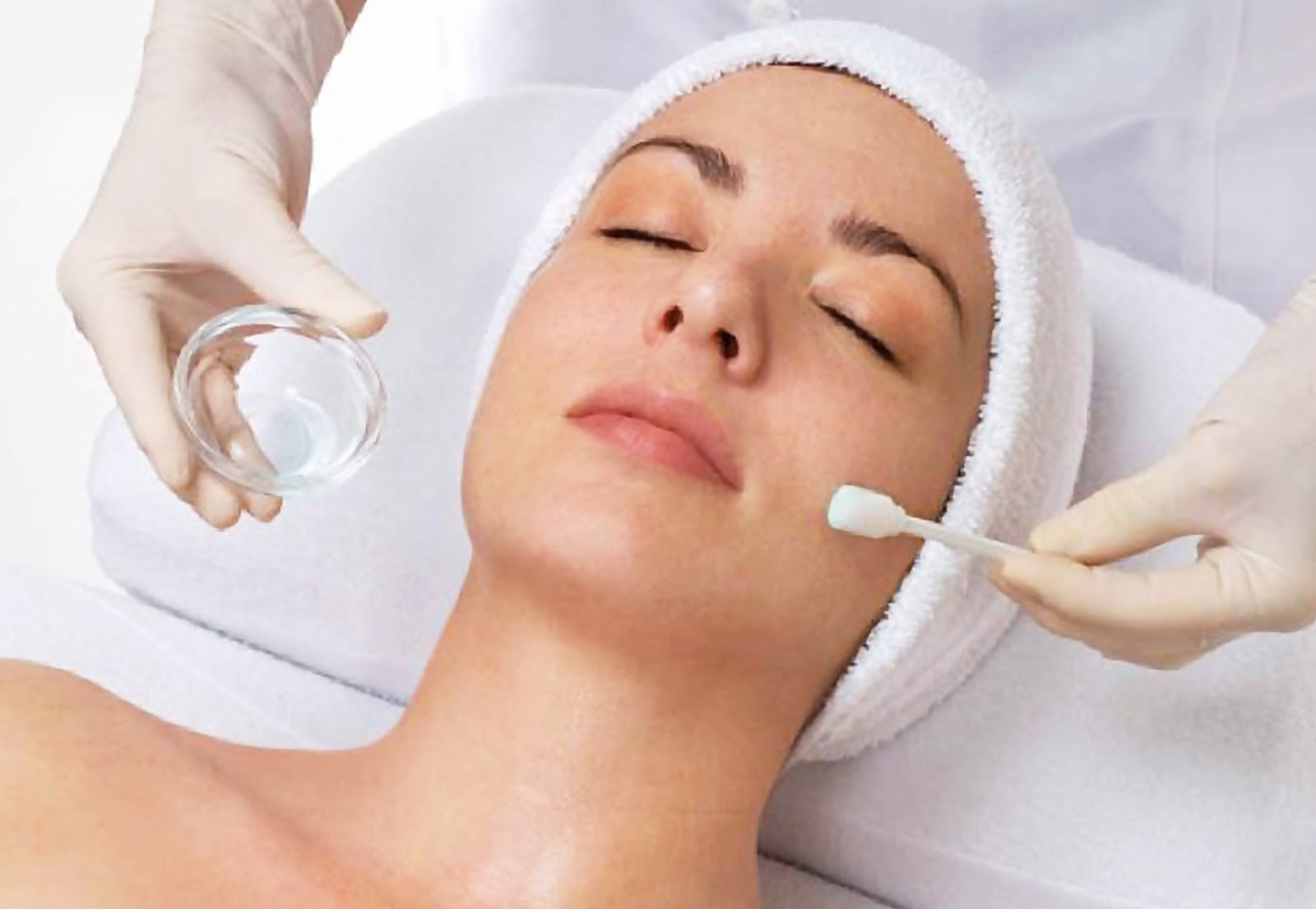 Ketahui Perbedaan Perawatan Laser dan <i>Chemical Peeling</i>