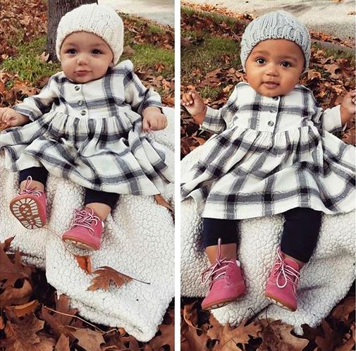 Dua Bayi Ini Kembar dengan Beda Warna Kulit