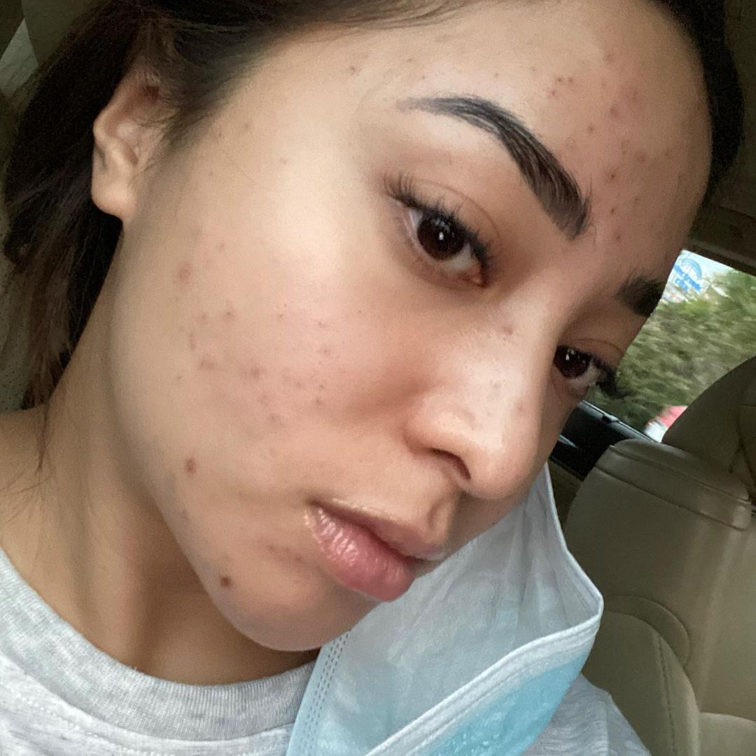 Nikita Willy Nangis Tiap Malam hingga Menolak Syuting Gara-Gara Hal Ini