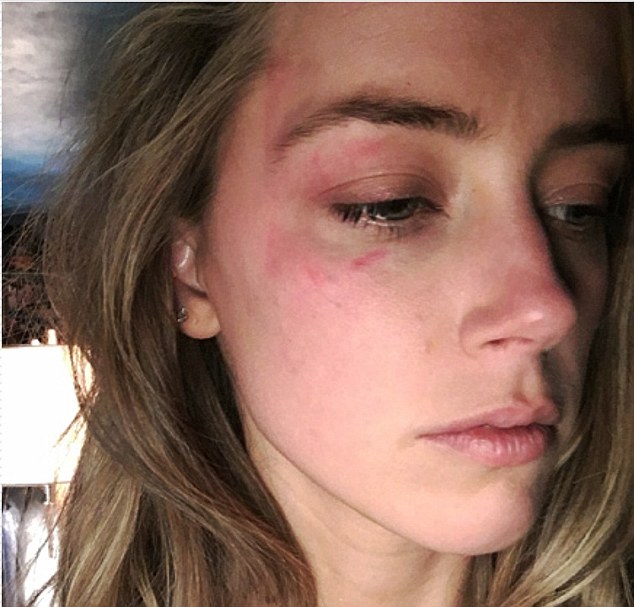 Amber Heard Ungkap Bukti KDRT yang Dilakukan Johnny Depp