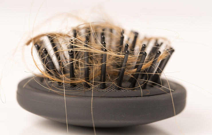 Inilah Pemicu Rambut Rontok dan Menipis