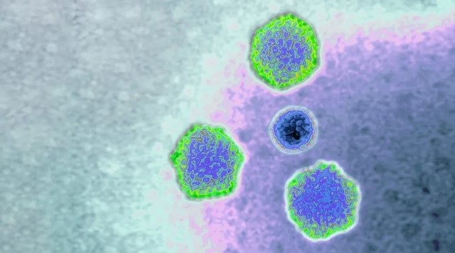 Adenovirus 41 penyebab hepatitis misterius