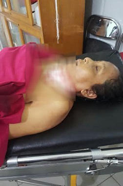 Dosen FKIP Meninggal akibat Luka Sayatan pada Lehernya