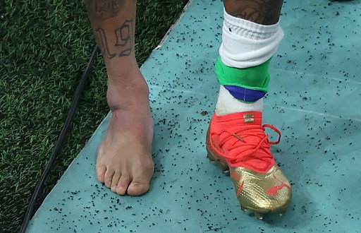 Ngilu! Begini Penampakan Kaki Neymar Usai Ditekel Pemain Serbia