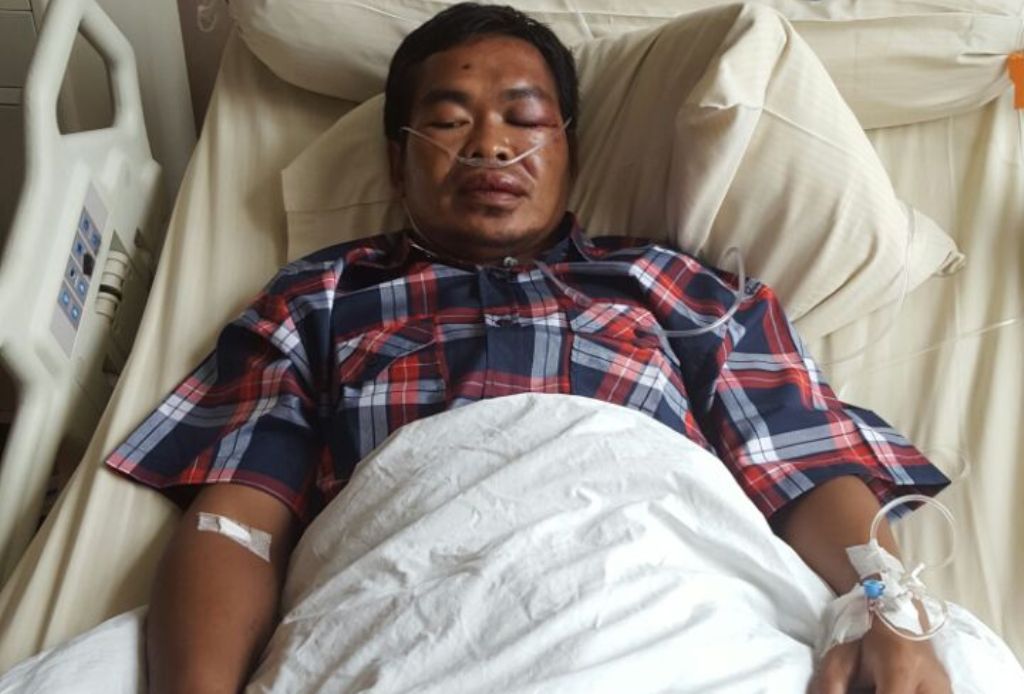Djarot Khawatir Ada Pendarahan di Otak