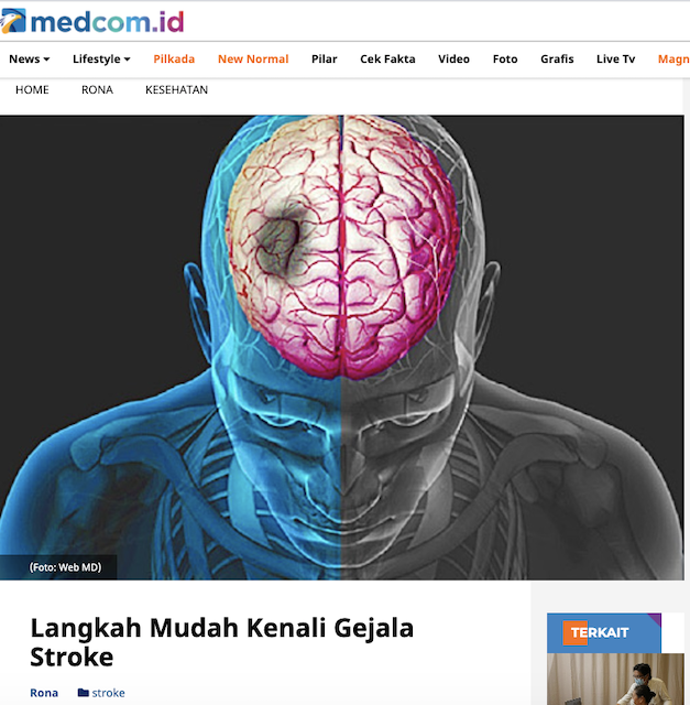 [Cek Fakta] Benarkah Menusuk Ujung Jari dengan Jarum Panas sebagai Cara Pertolongan Pertama Penderita Stroke? Begini Faktanya