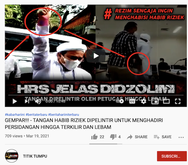 [Cek Fakta] Foto Tangan Rizieq Shihab Lebam Dipelintir Petugas? Ini Faktanya