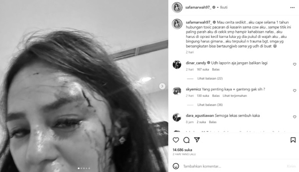 Selebgram Safa Marwah Dianiaya Pacar Gegara Tagih Utang Rp42 Juta