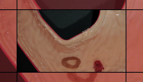 Ilmuwan MIT Ciptakan Robot untuk Sembuhkan Luka Dalam